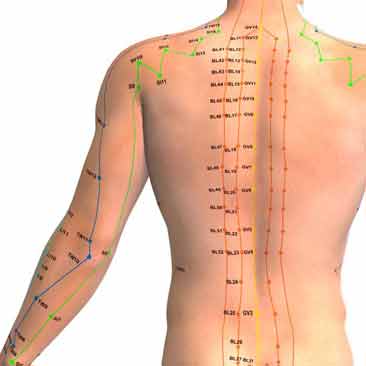 Acupuncture clinic in derby
